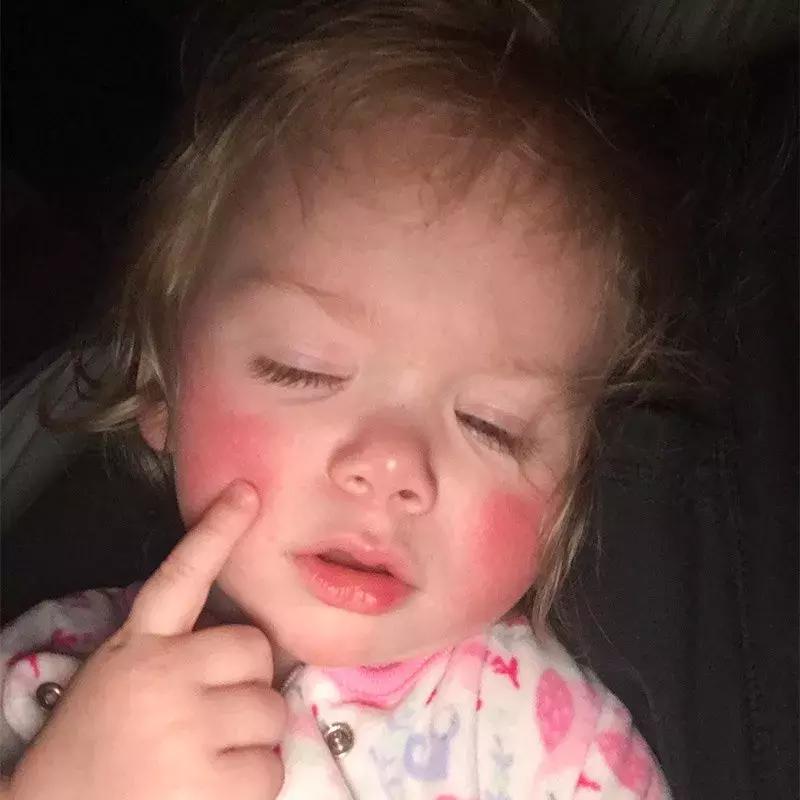 宝宝对净水器水过敏,对水过敏宝宝