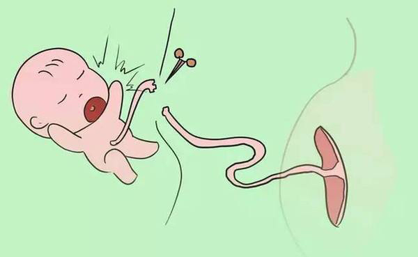 新生儿脐带的护理及异常情况处理,新生儿脐带护理及异常情况处理