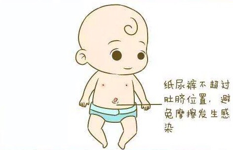 新生儿脐带的护理及异常情况处理,新生儿脐带护理及异常情况处理