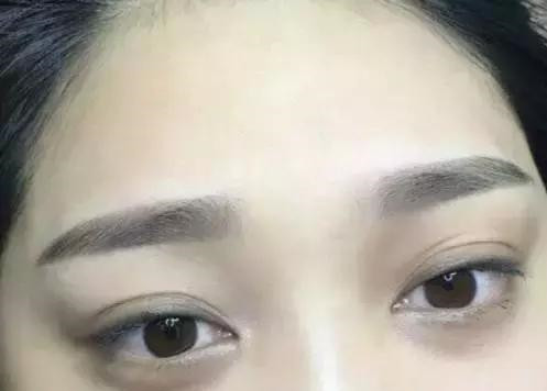 怎么让眉毛快速结痂掉痂,眉毛结痂掉痂修复过程
