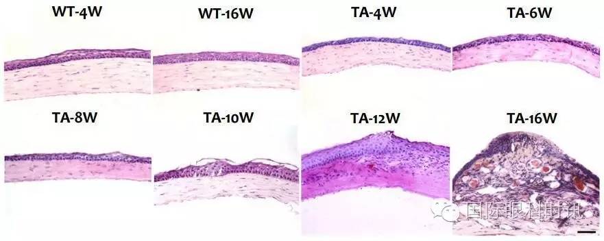 角膜会2016李炜教授:EDA基因突变鼠:一种新的睑板腺功能障碍相关性干眼动物模型