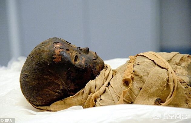 尸体为什么会发臭,尸体多久才会出现尸臭