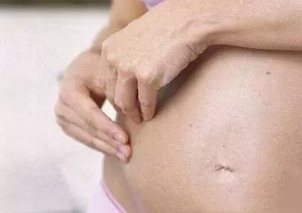 孕期皮肤瘙痒难忍？千万不可用手抓挠