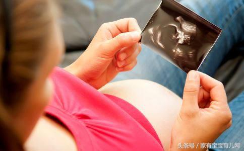 多少周胎盘成熟度到一级,产检单成熟度