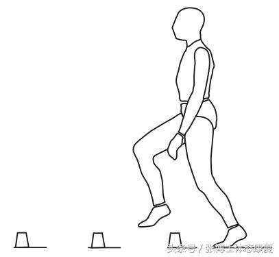 acl韧带重建手术后遗症,acl前交叉韧带重建第9天