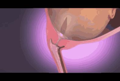 孕妈怀孕后羊水是怎样形成的,孕妈妈收藏