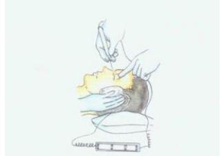 睫毛往眼睛里面长怎么回事,眼睫毛总是戳进眼睛为什么