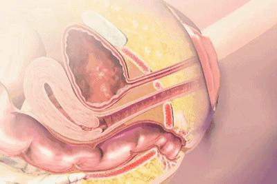 生完孩子后你有哪些后遗症？对症护理的要点，越早知道越好