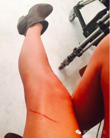 霉霉和她的猫咪,霉霉两只猫叫什么名字