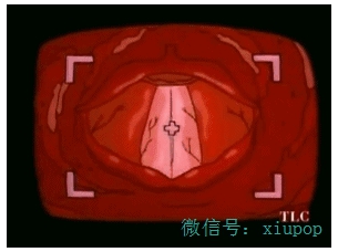 恶心干呕！别急，茶饮给你解决