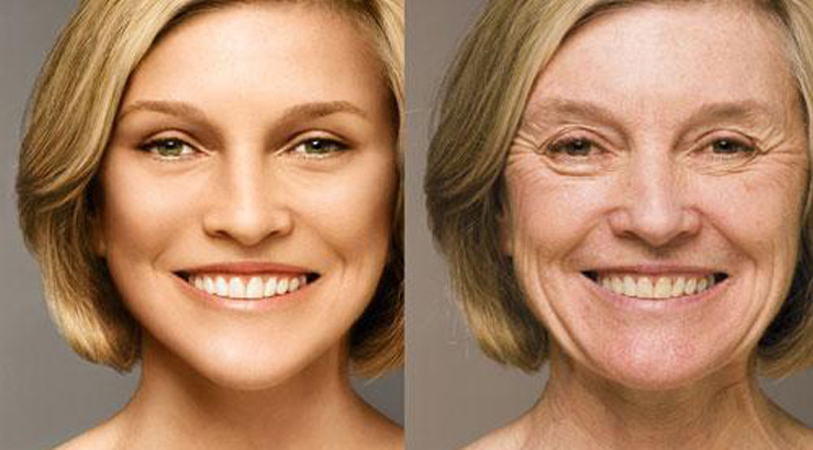 去皱纹美容的最有效方法,美容去皱纹的最好方法