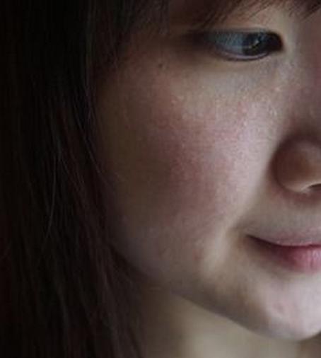 油敏感肌与干敏感肌的区别,不敏感皮可以用敏感护肤品吗