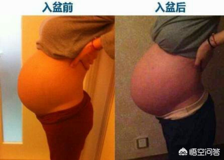 胎儿入盆，孕妈有哪些身体变化？