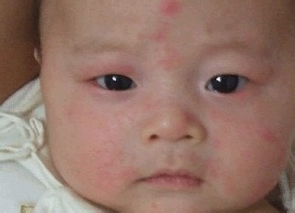 过敏宝宝辅食添加时间顺序和种类,鸡蛋牛奶小麦大米过敏的宝宝辅食