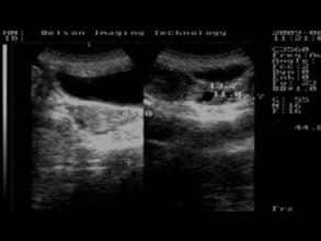 《妇科检查大全》及相关作用，女人，你值得拥有！