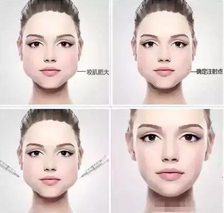 纠结要不要去打水光针,纠结要不要打九价