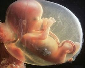 五个月大的胎儿腹死，什么原因引起？孕妈们该如何预防死胎发生？