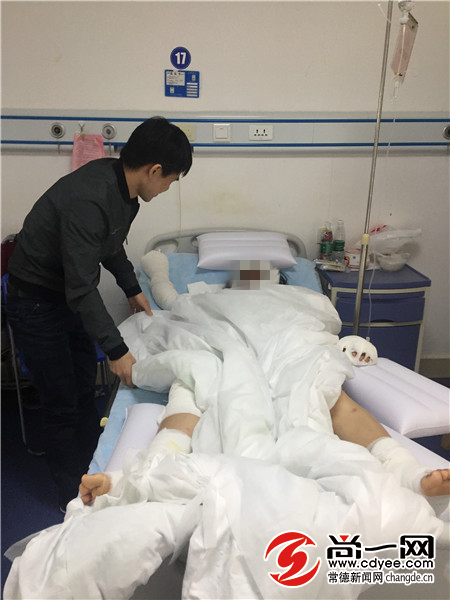 烧伤恢复期疼痛吃止痛药行吗,孕妇烧伤怎么处理