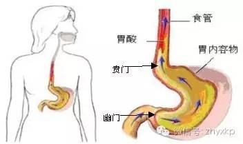 一言不合就吐是什么情况,一言不合就吐口水原因