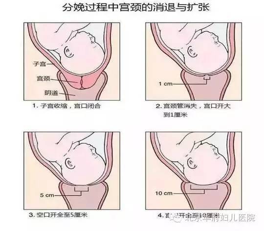 “开十指”是什么意思孕妈们误解了吗？