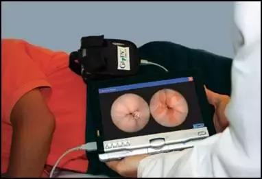 消化道胶囊内镜,胶囊内镜可以看到全部消化道吗