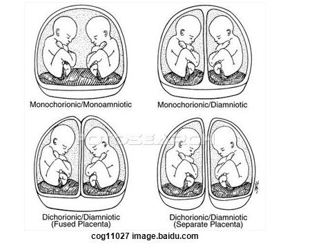 奇趣ai,奇趣ai有啥用