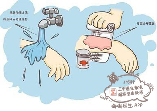 宝宝烫伤百分之二十五严重吗,宝宝烫伤快好了妈妈还要忌口吗