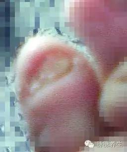 脚臭脚气灰指甲用什么药最好,灰指甲脚气脚臭脚脱皮