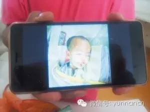 爆竹爆炸小孩受伤,儿童玩杀虫剂爆炸事件