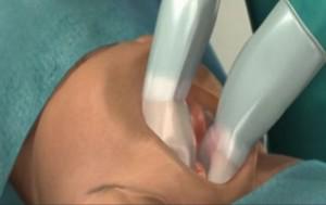 分娩时进行“剖腹产”手术全过程（附图）