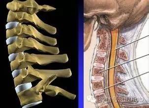 保护颈椎放松肩部远离颈椎病,保护颈椎别忽视枕头的选择