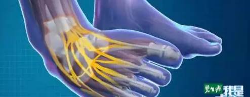 从脚看出疾病征兆,脚型不好看是怎么回事