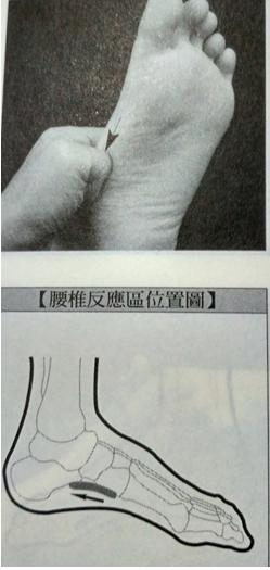 腰椎间盘突出的治疗方法的短视频,腰椎间盘突出的治疗方案有哪些