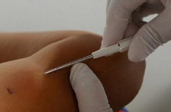 伤害性较小的避孕措施,伤害最小的避孕方法