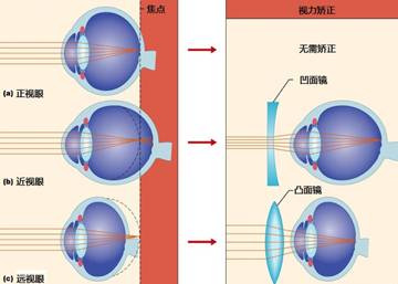 辟谣特工队|一招恢复视力，敢信吗？
