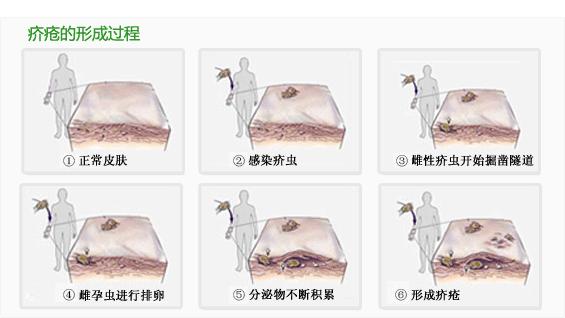 构树皮怎样治皮肤病,构树皮怎么用治皮肤病
