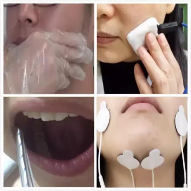 周惠嫦主任：鼻咽癌放疗后吞咽康复治疗的方法