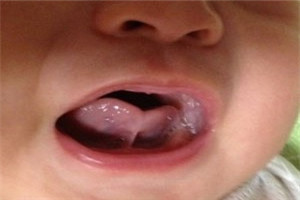 产房怪事,产房出生的奇怪婴儿