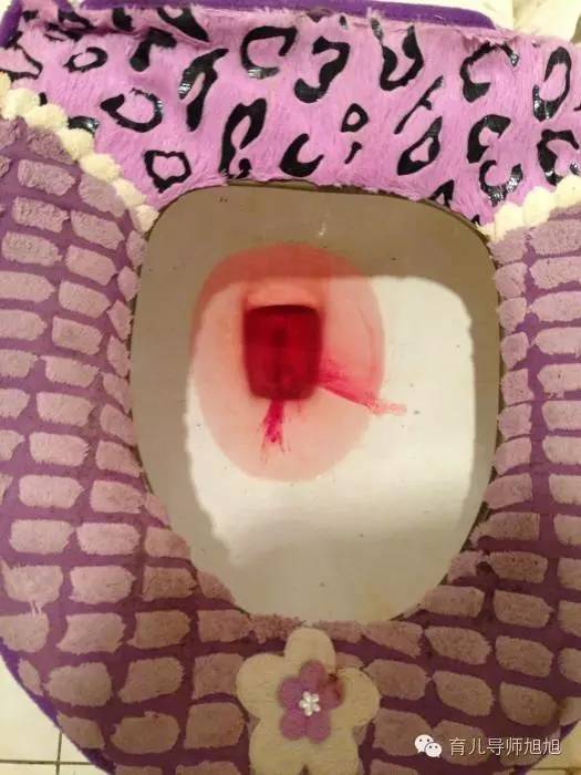 新生儿全身恶臭口吐白沫，家人痛哭但医生却说是妈妈害的