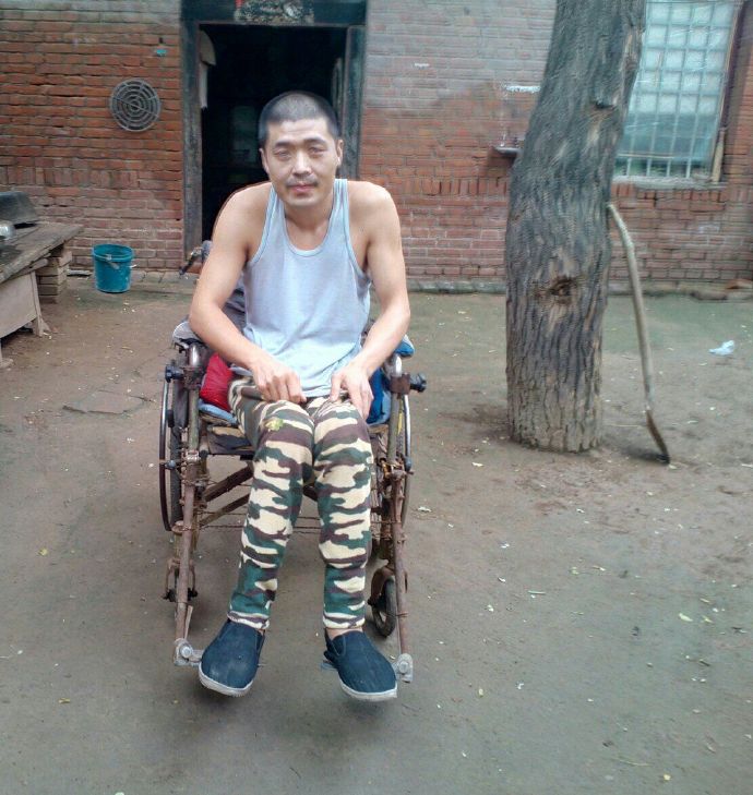 不完全性截瘫怎么治,截瘫怎么解决