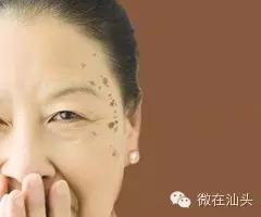 点痣会引发痣癌变吗,痣旁边长了小痣是不是癌变