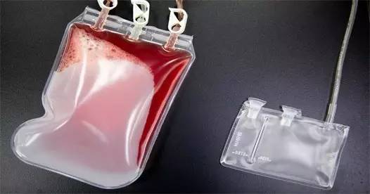 脐带血要不要保存看了你就明白,脐带血到底要不要保存案例