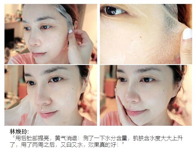 不打针不吃药也可以打通微循环,不打针能好吗