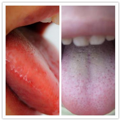 红豆薏米茶千万别乱喝,薏米红豆汤祛湿