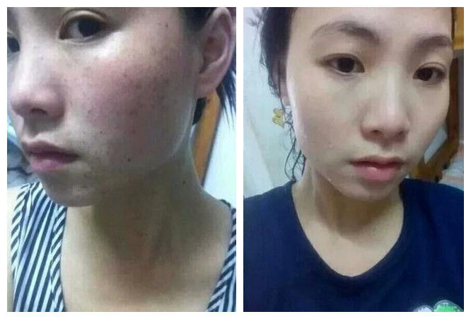 你还在市面上买昂贵的护肤品吗,你还在到处找美白方法和护肤品吗