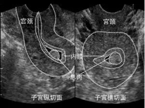 试管婴儿成功后多长时间检查一次,试管婴儿一周做一次超声