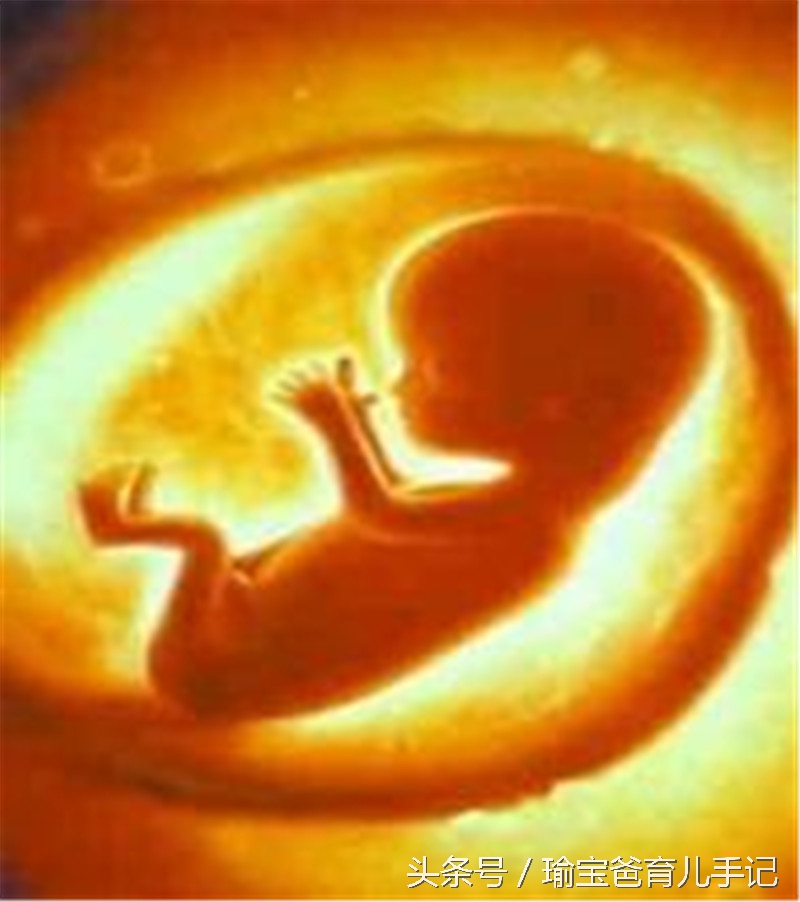 怀孕八个月胎儿心脏间隔缺损,胎儿肾盂分离需要引产吗