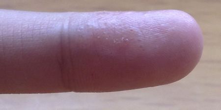 8岁男孩身患怪病,男孩患怪病的真实案例