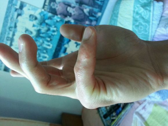 8岁男孩身患怪病,男孩患怪病的真实案例