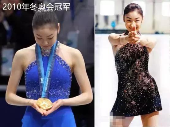 奥运冠军也爱美瘦脸箍牙后她们都美啦